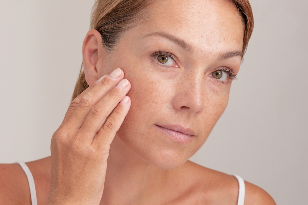 Woman with freckles looking in the mirror after IPL in Ashburn, VA